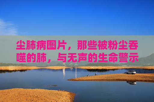 尘肺病图片,那些被粉尘吞噬的肺,与无声的生命警示,粉尘吞噬的肺,无声的生命警示 尘肺病图片,那些被粉尘吞噬的肺,与无声的生命警示,粉尘吞噬的肺,无声的生命警示